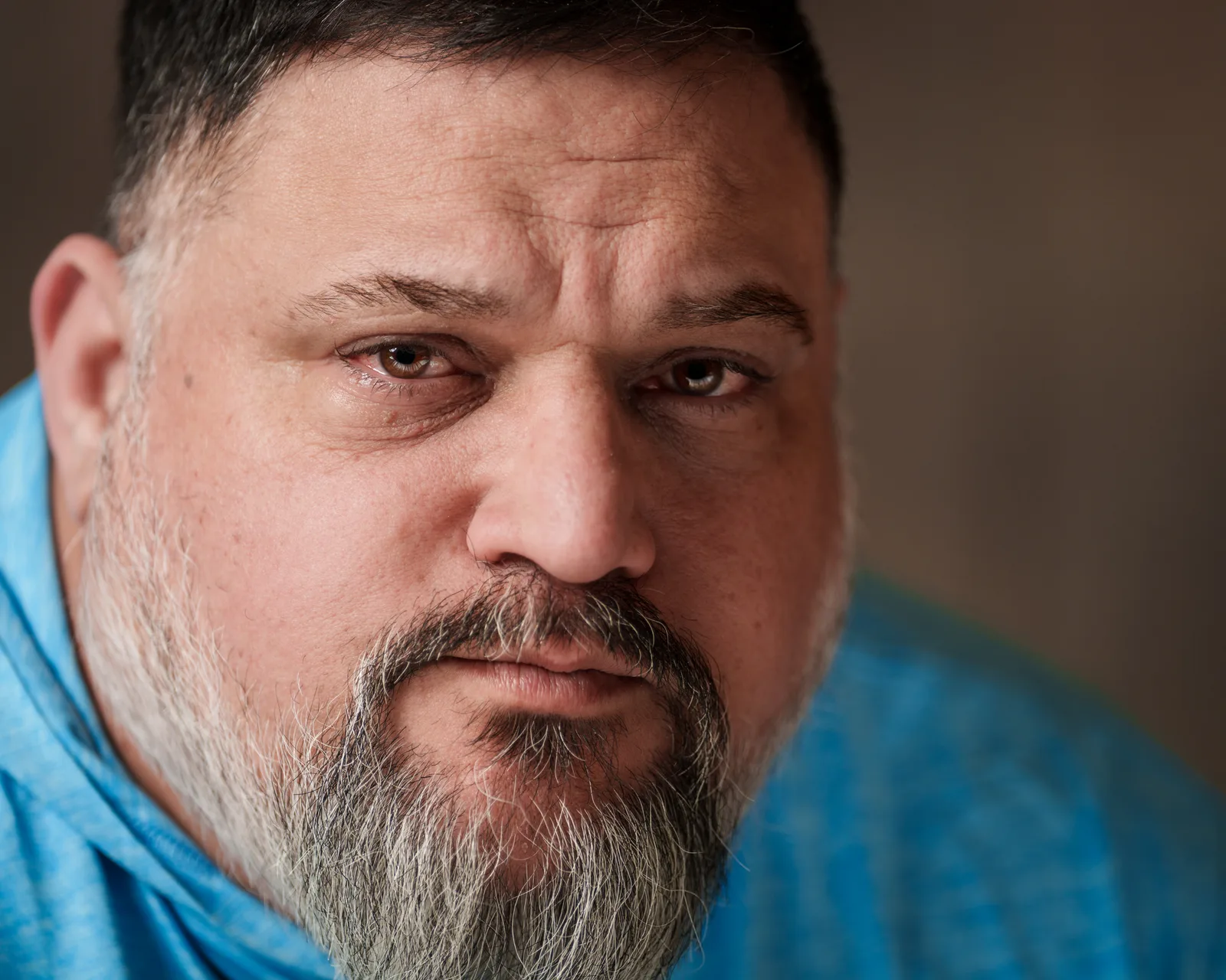 Extreme close-up of a bearded man's face, brown eyes rimmed red, brow furrowed, in a blue shirt against a dark background.