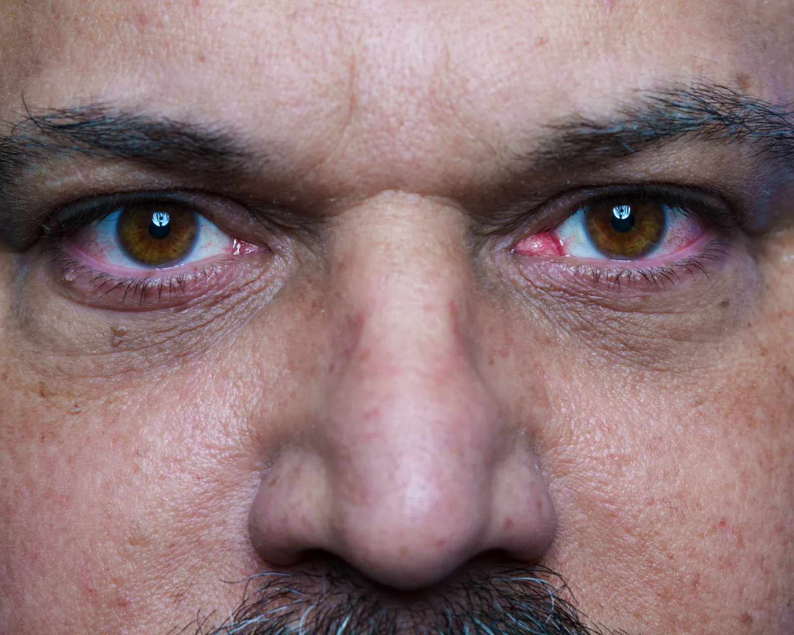Extreme close-up of a man's face cropped to the eyes and nose, brown eyes bloodshot, skin showing pores and creases.